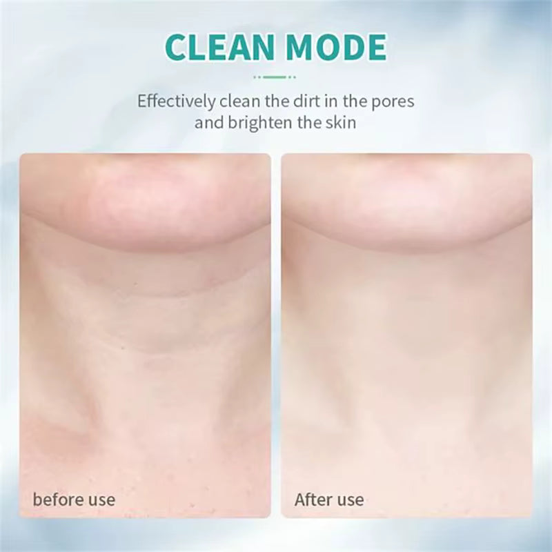 Face & Neck Lift Massager
